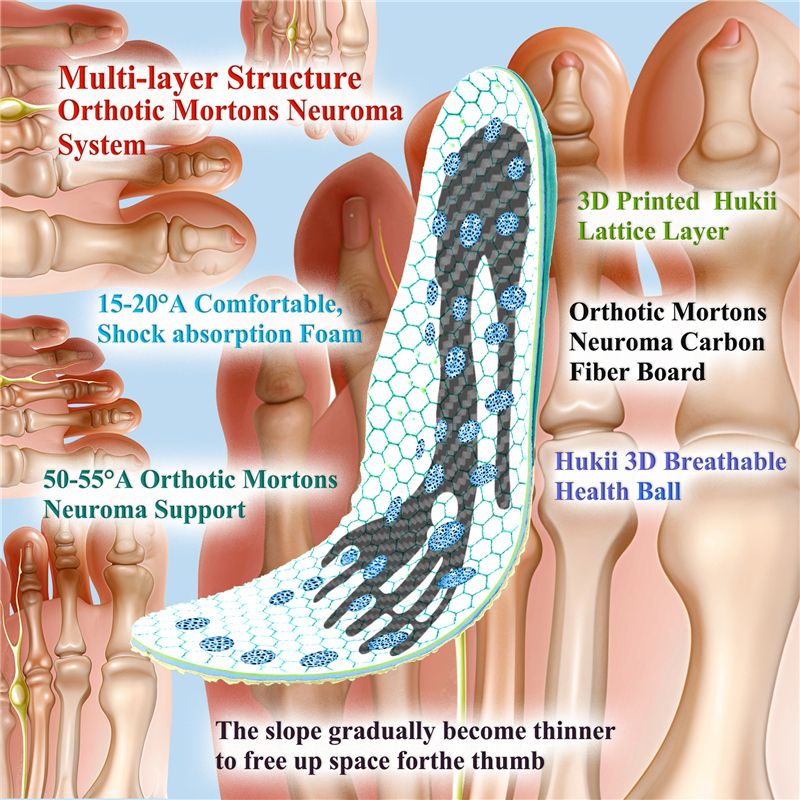 Mortons Neuroma Insoles