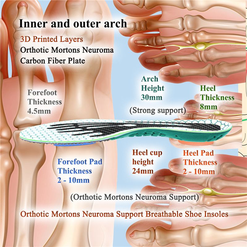 Mortons Neuroma Insoles