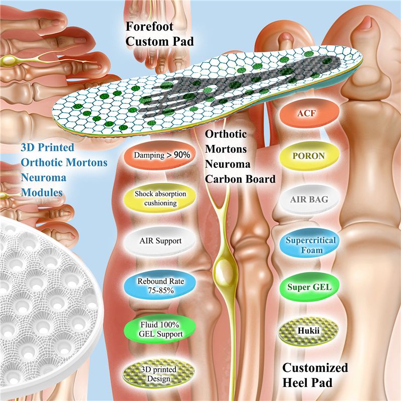Mortons Neuroma Insoles