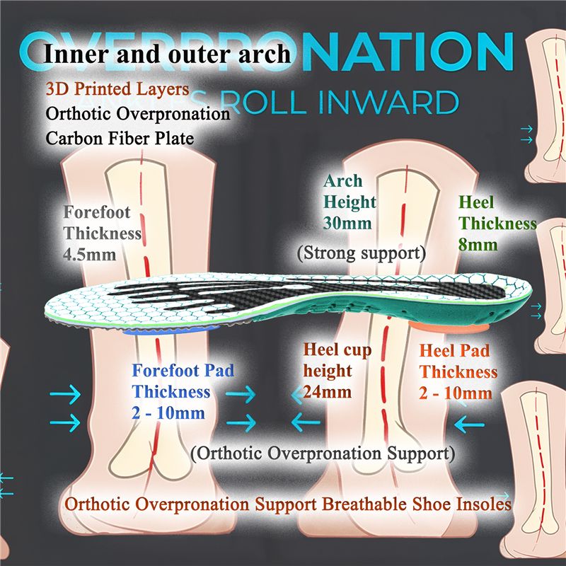 Overpronation Insoles