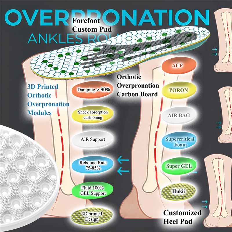 Overpronation Insoles