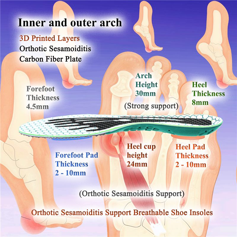 Sesamoiditis Insoles