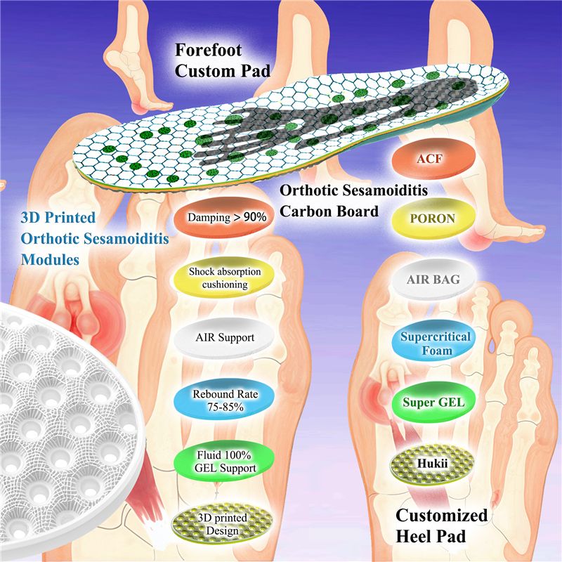 Sesamoiditis Insoles