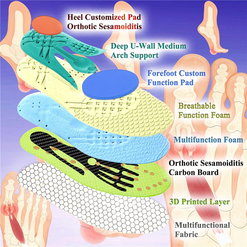 Sesamoiditis Insoles