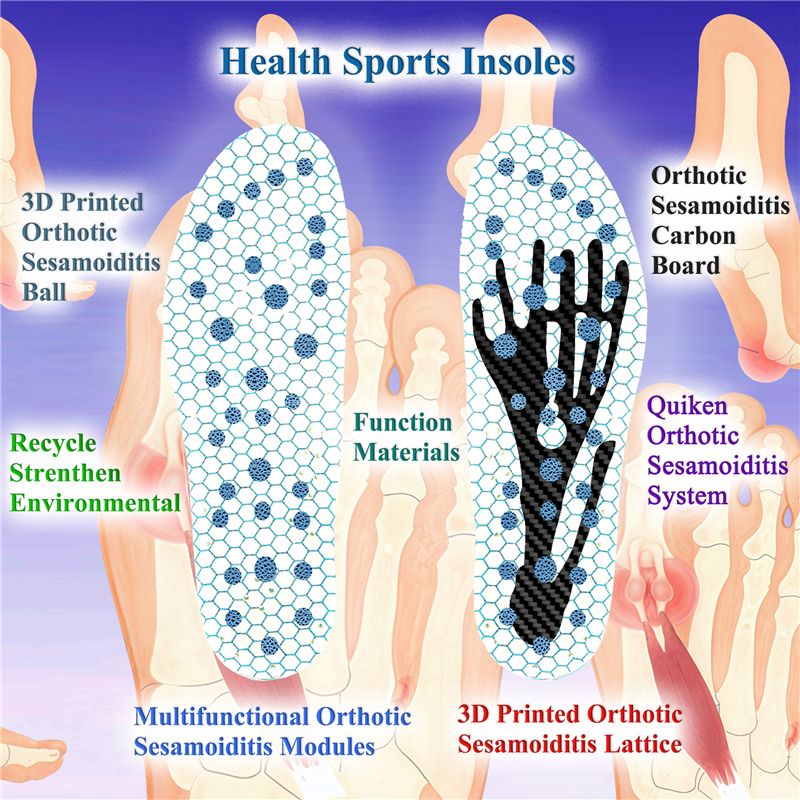 Sesamoiditis Insoles