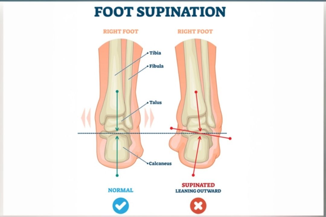 Supination